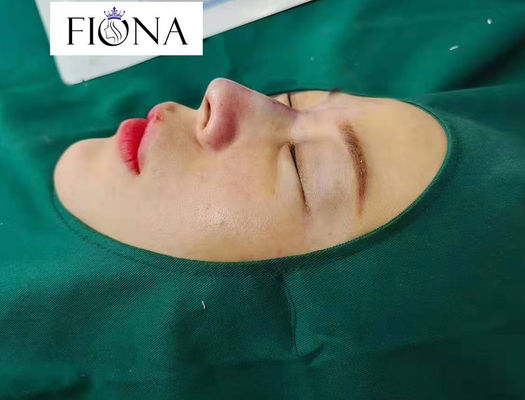 Ascensore del naso del filo del dente di PCL 70mm che rimodella trattamento