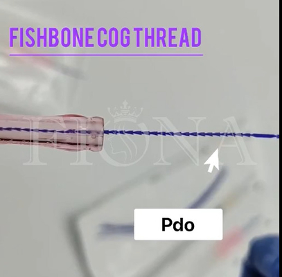 Filo del dente del modanatura del Fishbone