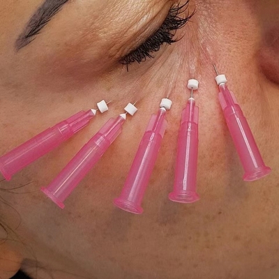 il filo assorbibile di 25mm Pdo Pcl solleva il tipo cannula smussata di W per perdita di sotto del volume dell'occhio